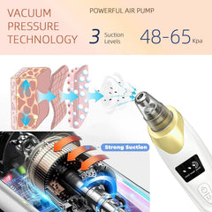 Echtur Vacuum Niveaux-aspiration: ajustement facile selon le type de peau