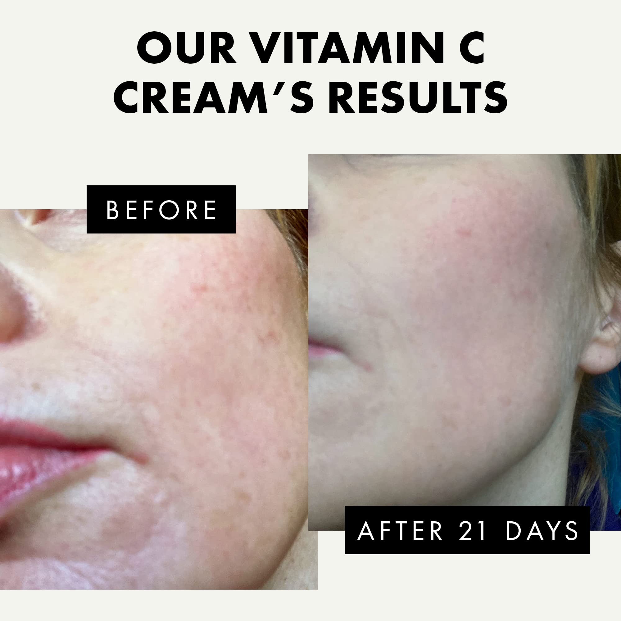 Uso diario: aplicación diaria de Eclat Skincare Vitamina C para piel más fresca