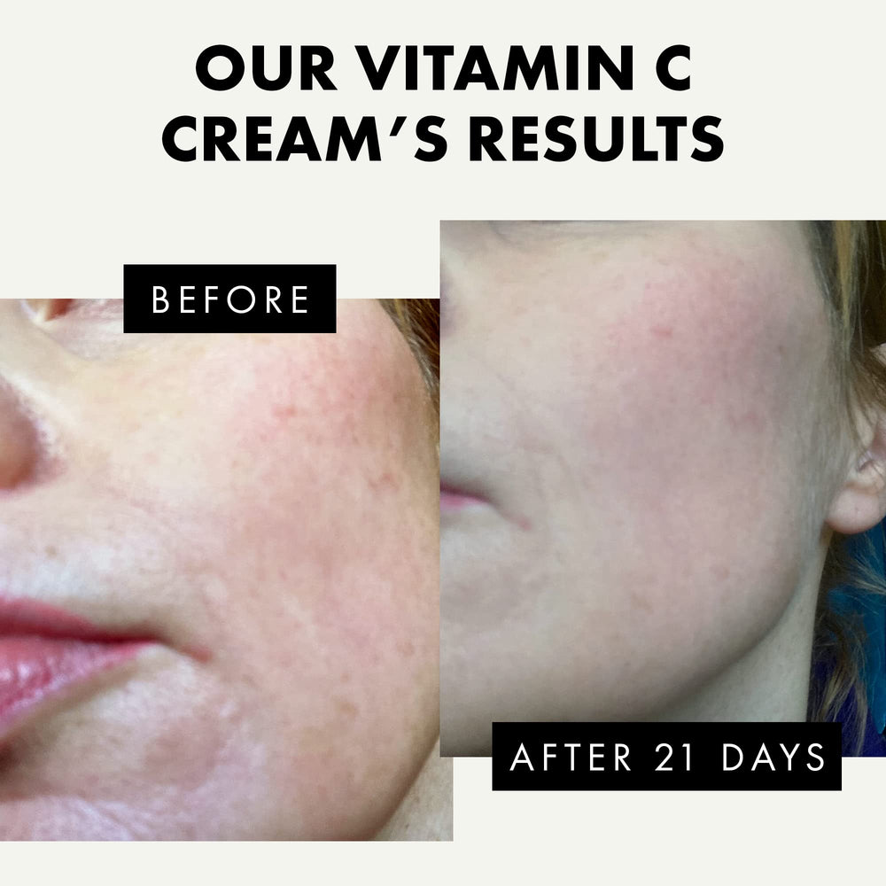Uso diario: aplicación diaria de Eclat Skincare Vitamina C para piel más fresca