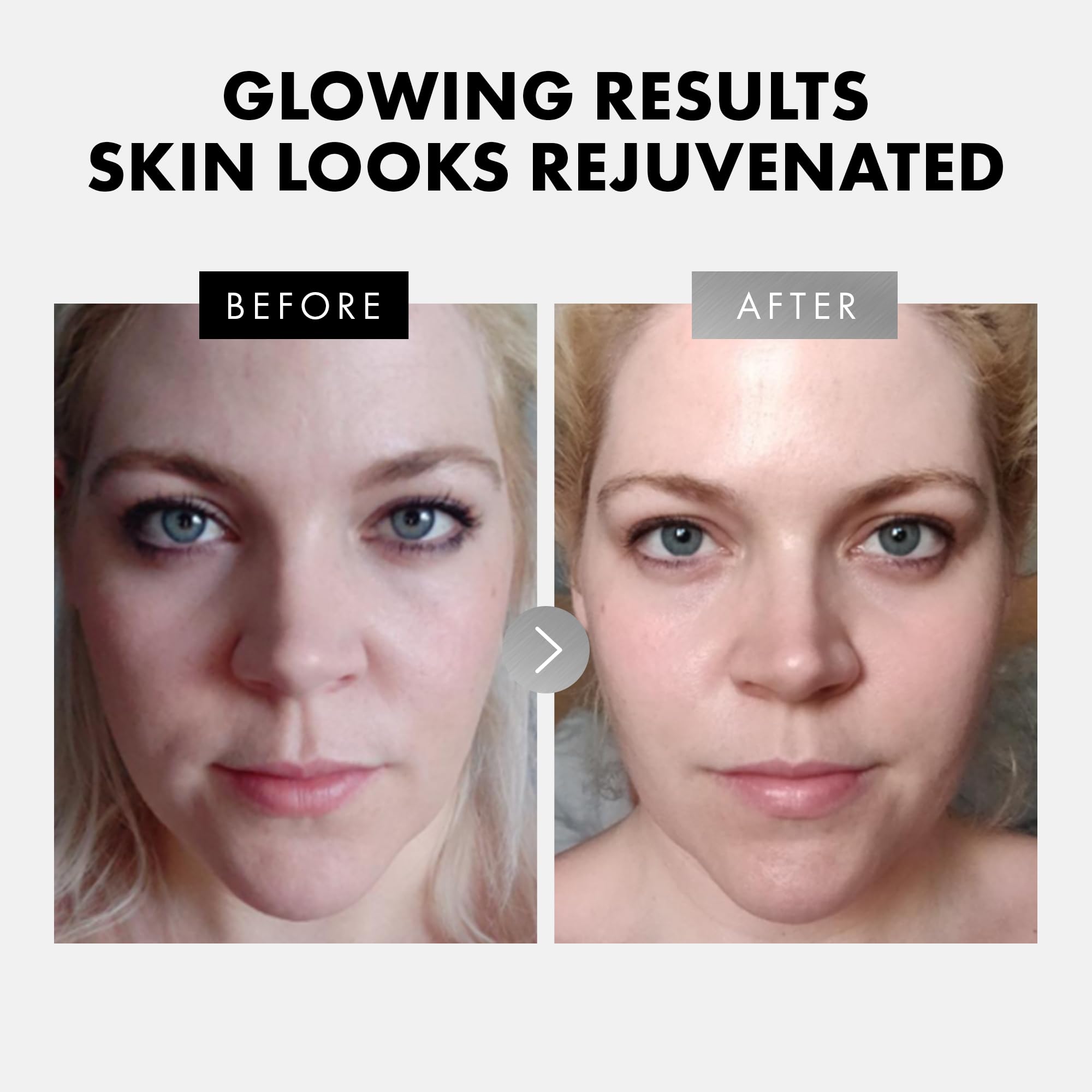 Eclat Skincare: dúo de serums, ideal para renovar la rutina de cuidado