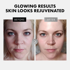 Eclat Skincare: dúo de serums, ideal para renovar la rutina de cuidado