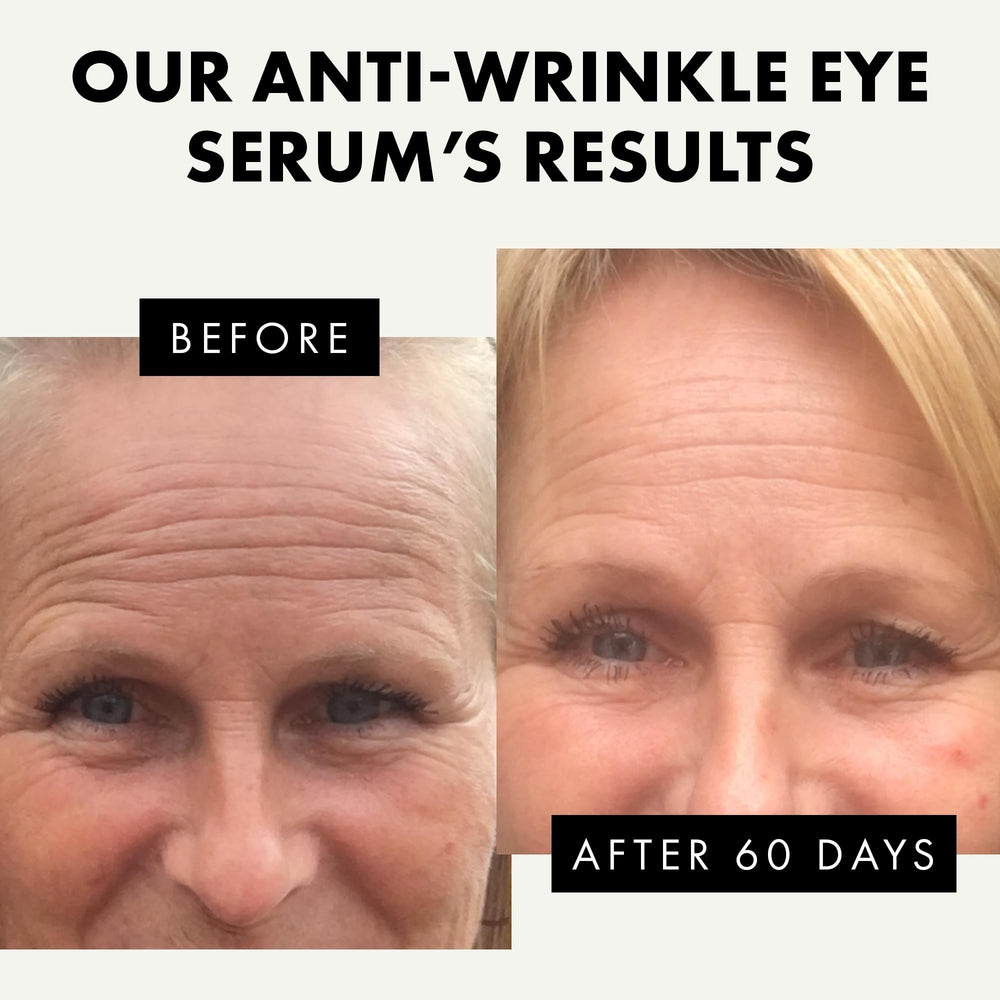 Sérum para ojos Eclat Skincare: reduce bolsas y ojeras visibles