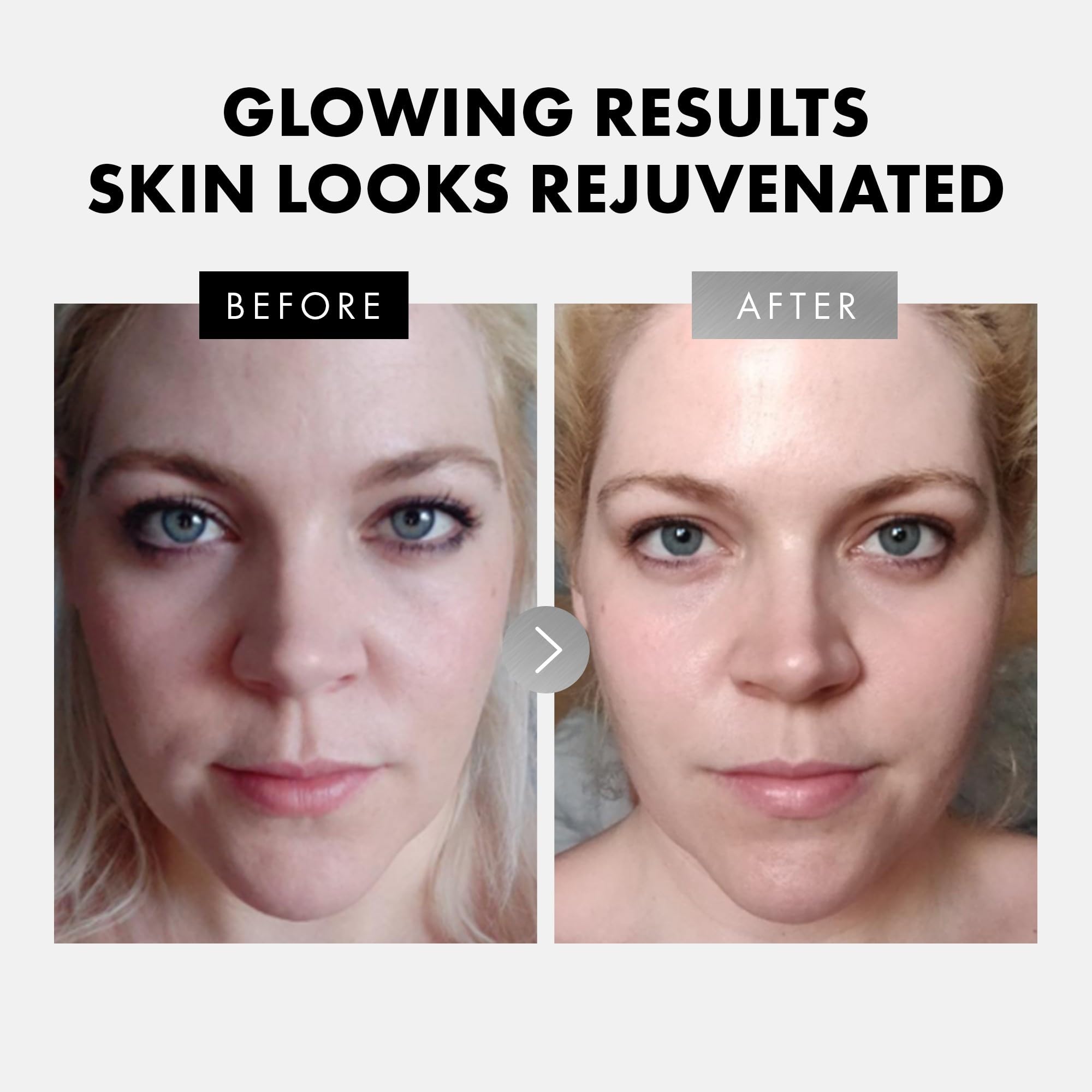 Eclat Skincare ácido hialurónico: hidrata profundamente y aporta firmeza.