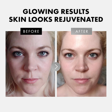 Eclat Skincare ácido hialurónico: hidrata profundamente y aporta firmeza.