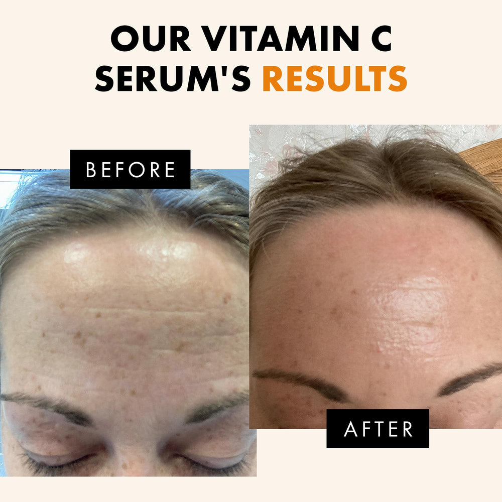 Eclat Skincare Vitamin C Serum, aplicación manual, brinda hidratación de 24h.