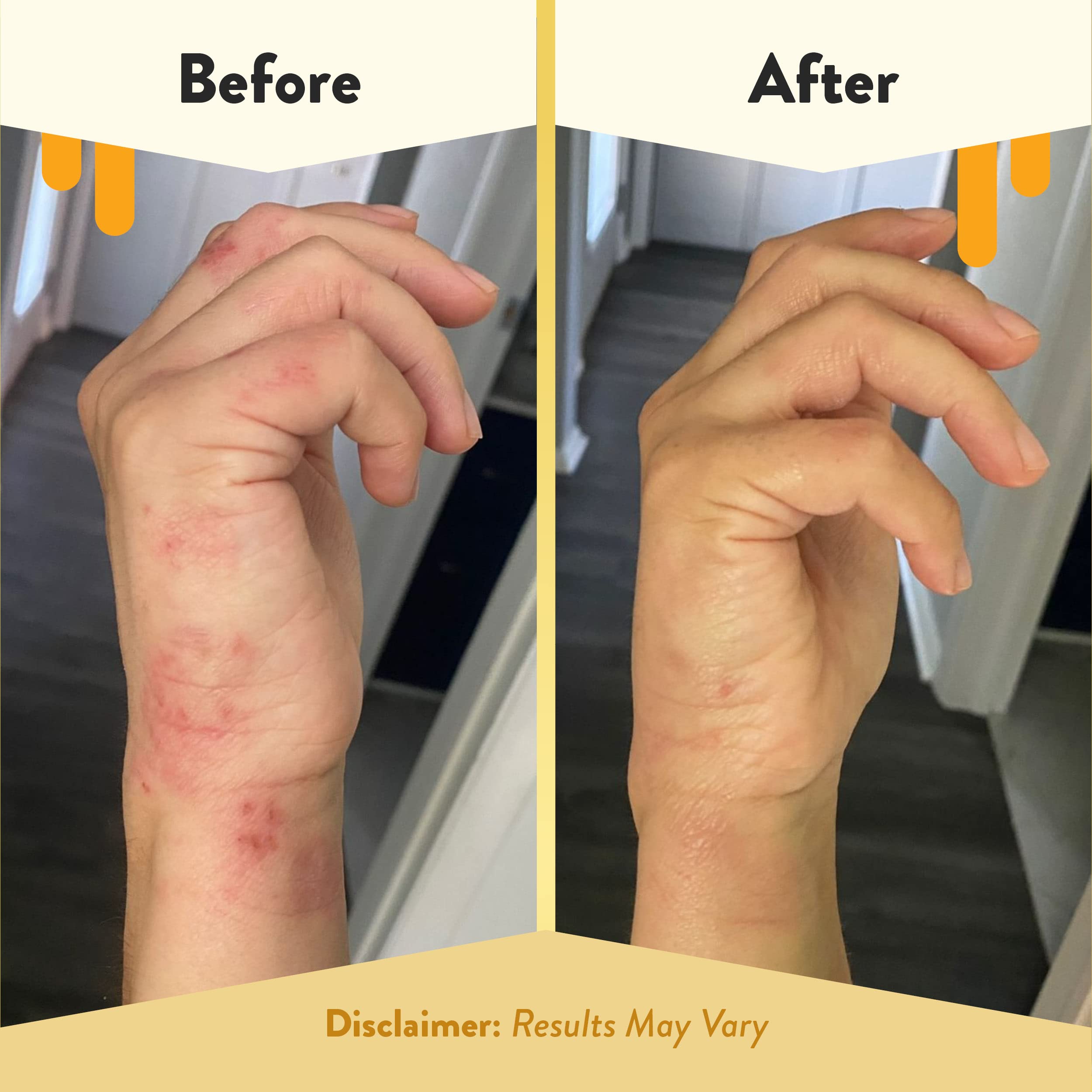 ECZEMA HONEY Fórmula nutritiva con argán y jojoba para piel seca.