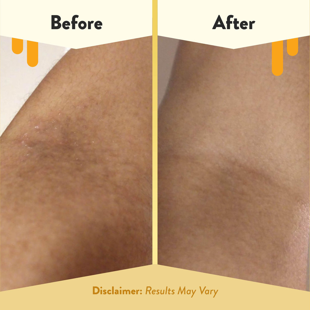 ECZEMA HONEY miel y té verde, ingredientes naturales para nutrir la piel.