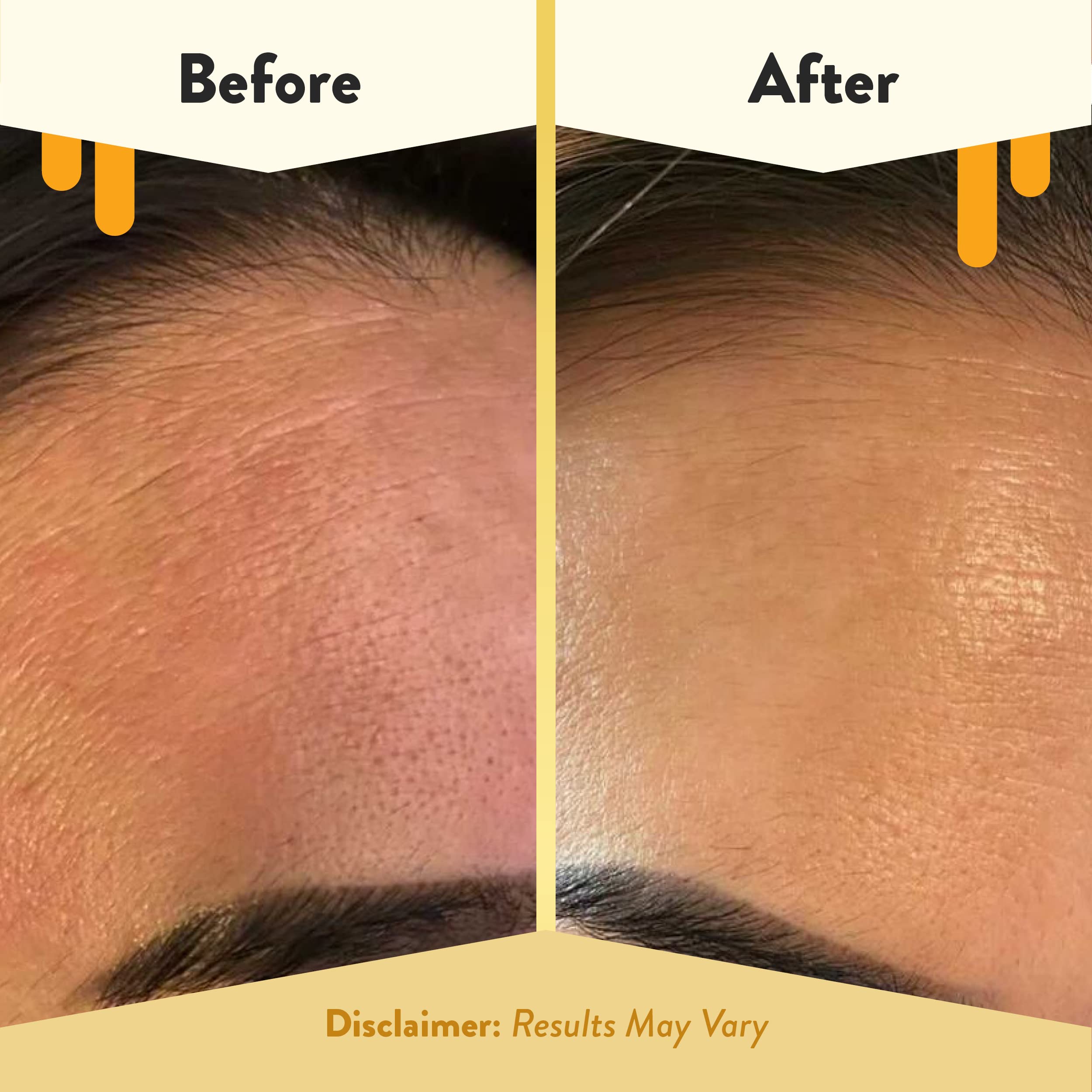 Eczema Honey Nourishing Face Serum ingredients highlighting oat extract for irritation support