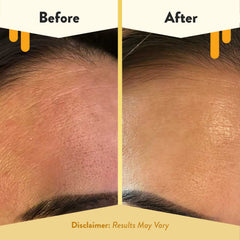 Eczema Honey Nourishing Face Serum ingredients highlighting oat extract for irritation support
