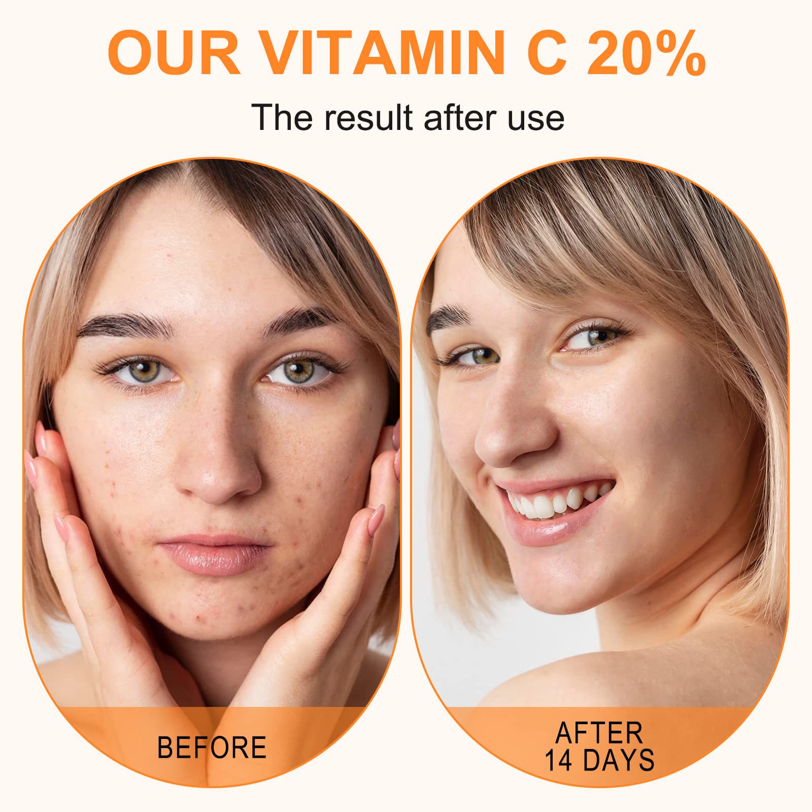 ELBBUB Serum Vitamina C 20 ml, ingredientes naturales para cuidado facial