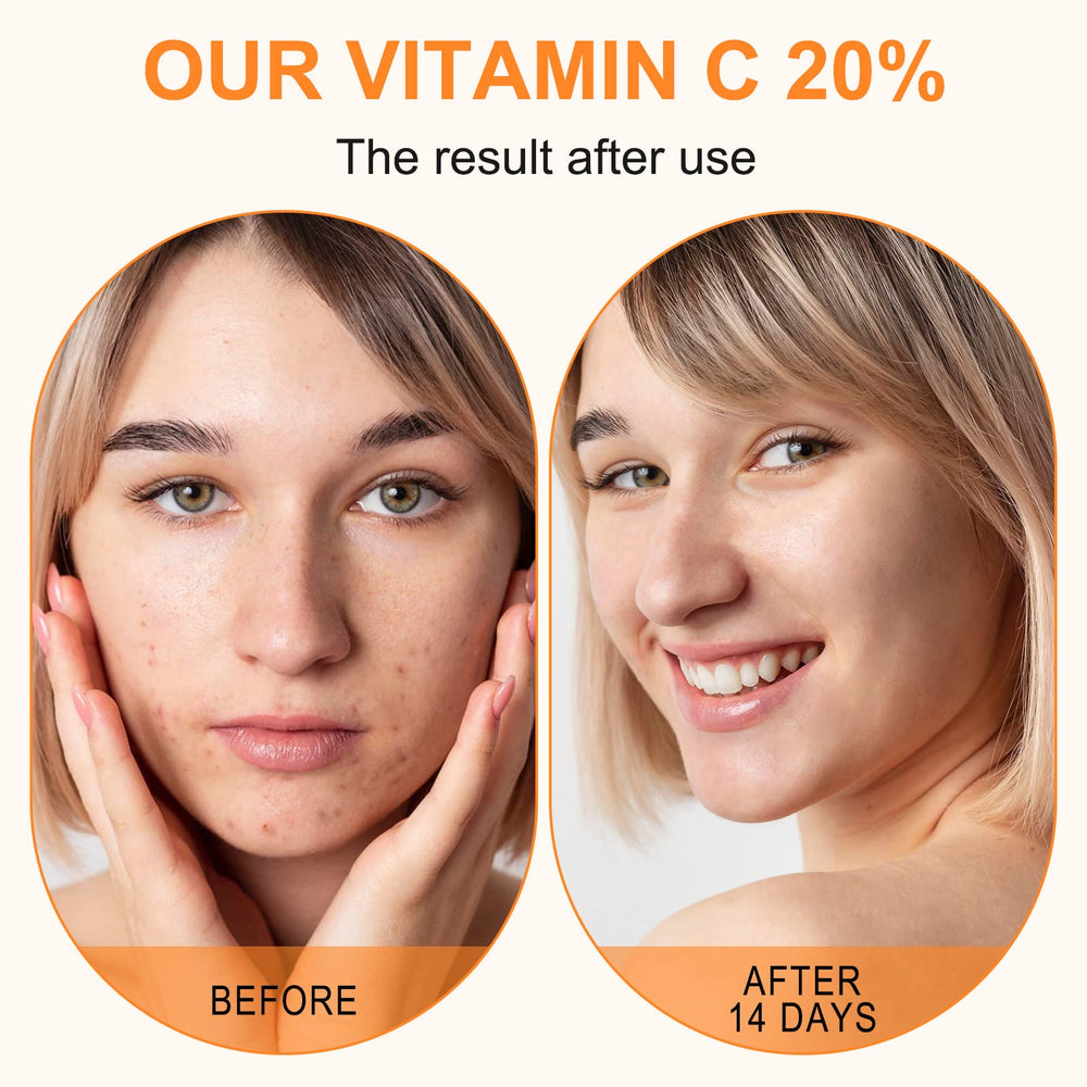 ELBBUB Serum Vitamina C 20 ml, ingredientes naturales para cuidado facial