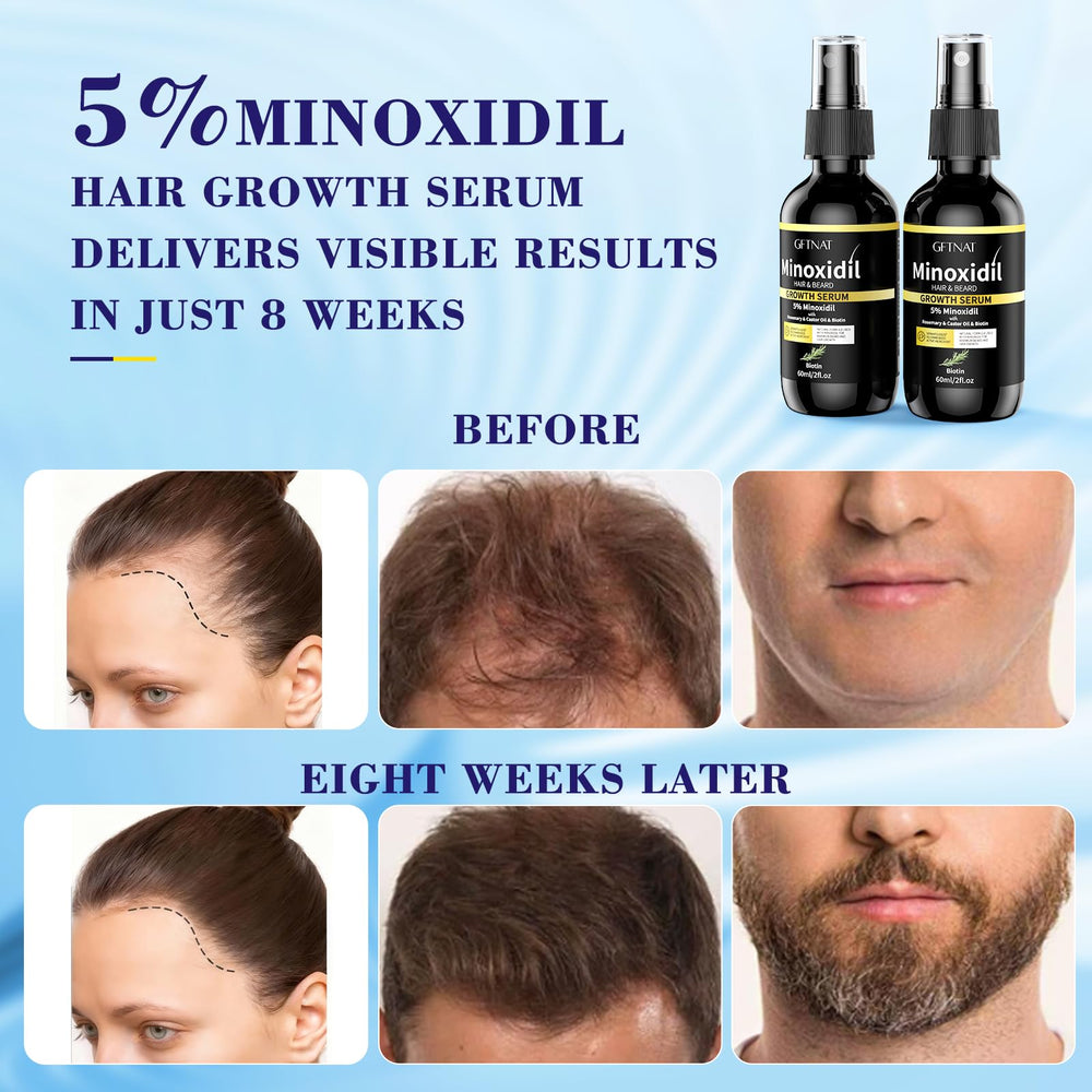 Absorción en 60 segundos de Elegra Minoxidil, sin grasa.