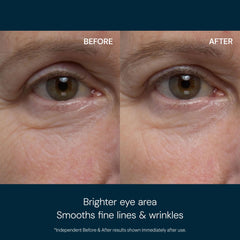 Textura gel refrescante de Elemis deshincha y refresca la mirada.