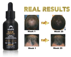 Elevate extracto de ginseng: aceite natural para cabello.