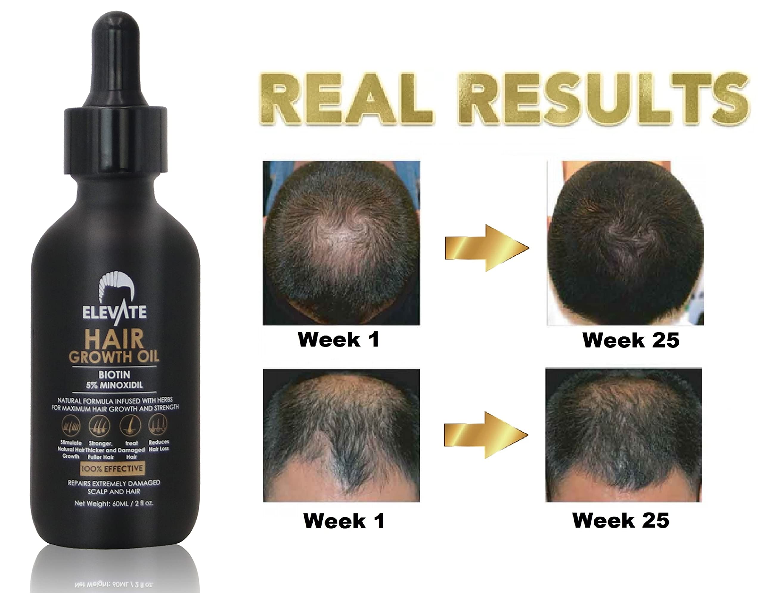 Cabello más grueso y fortalecido con Elevate Regrowth Serum.