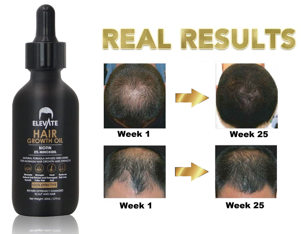 Cabello más grueso y fortalecido con Elevate Regrowth Serum.