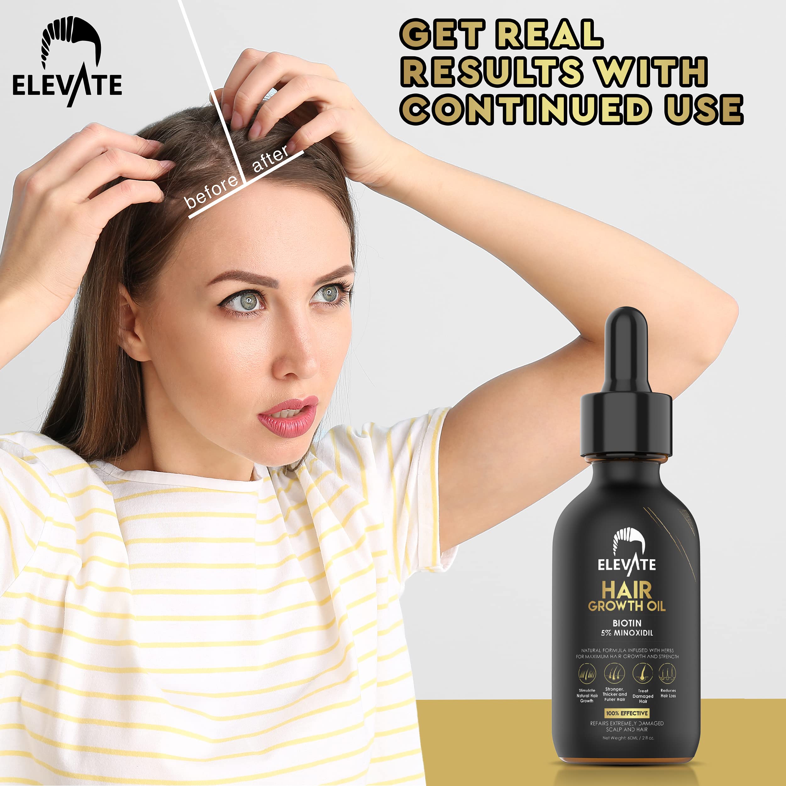Gotas de Elevate Regrowth Serum con minoxidil y biotina para fortaleza de mechones.