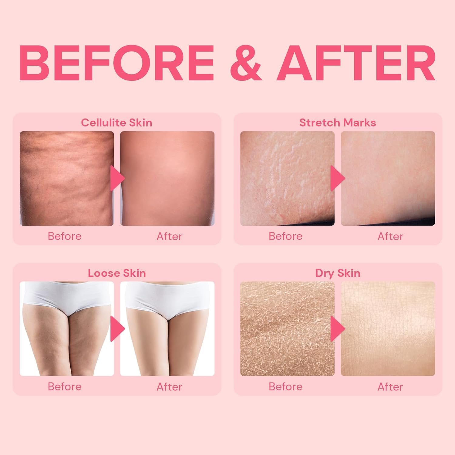 Enaskin Naturals anti-cellulite cream bottle label close-up, clean, skin-safe formula.