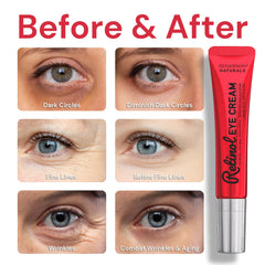 Enaskin Naturals, caja del producto destacada para el cuidado de ojos.