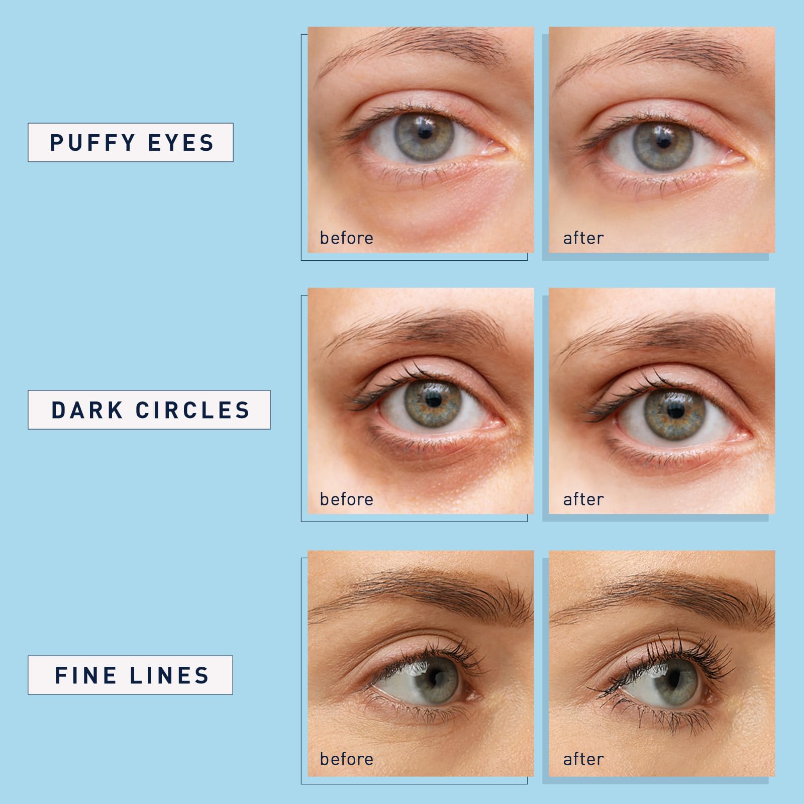 Enaskin Naturals eye-area care visuals suggest refreshed appearance with moisture boost.