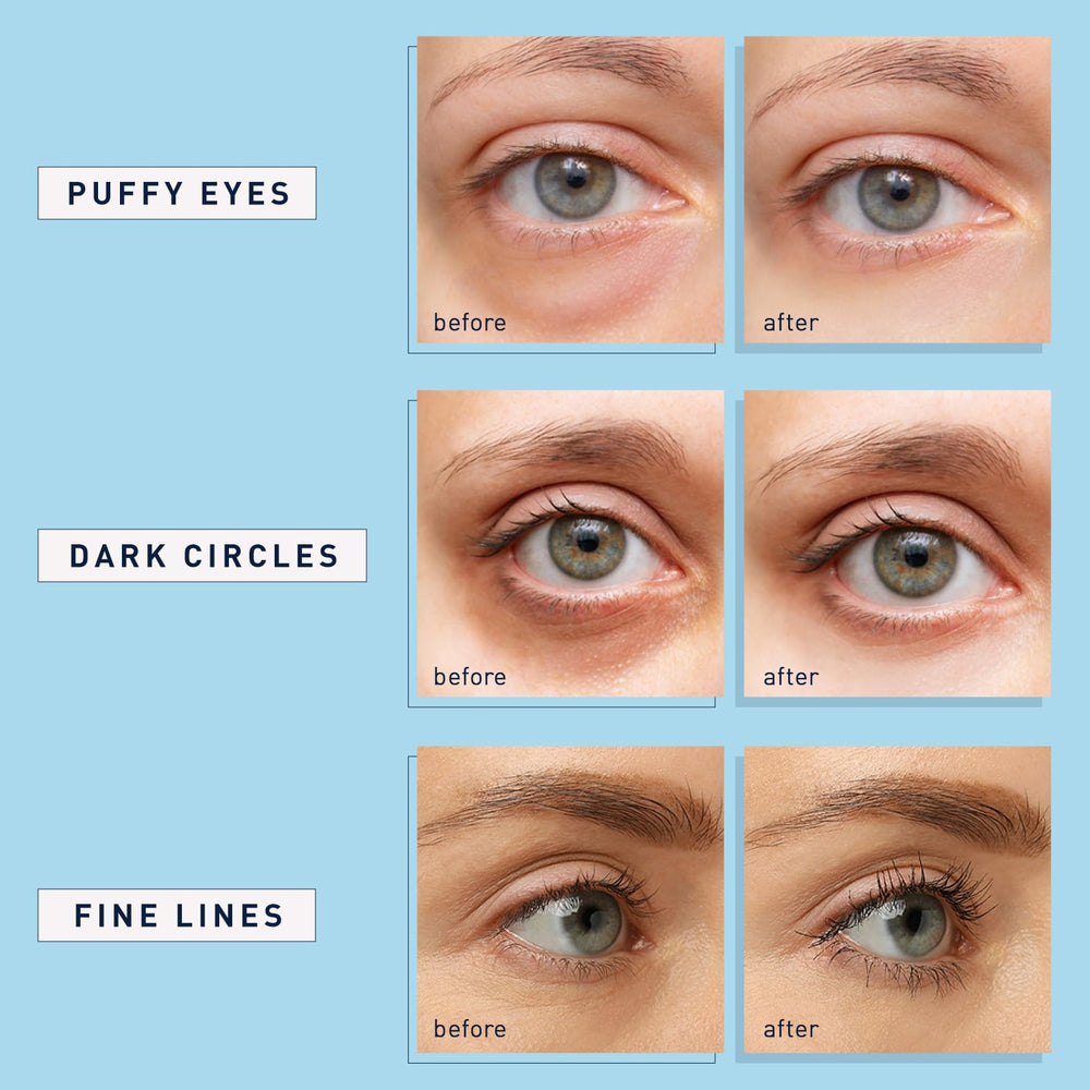 Enaskin Naturals eye-area care visuals suggest refreshed appearance with moisture boost.