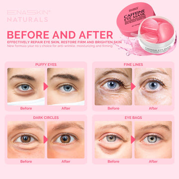 Mascarillas de gel Enaskin Naturals para ojos, hidratantes y calmantes.