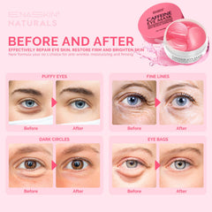 Mascarillas de gel Enaskin Naturals para ojos, hidratantes y calmantes.