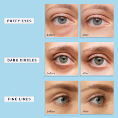 Aplicación fácil de 20 minutos para ojos con Enaskin Naturals