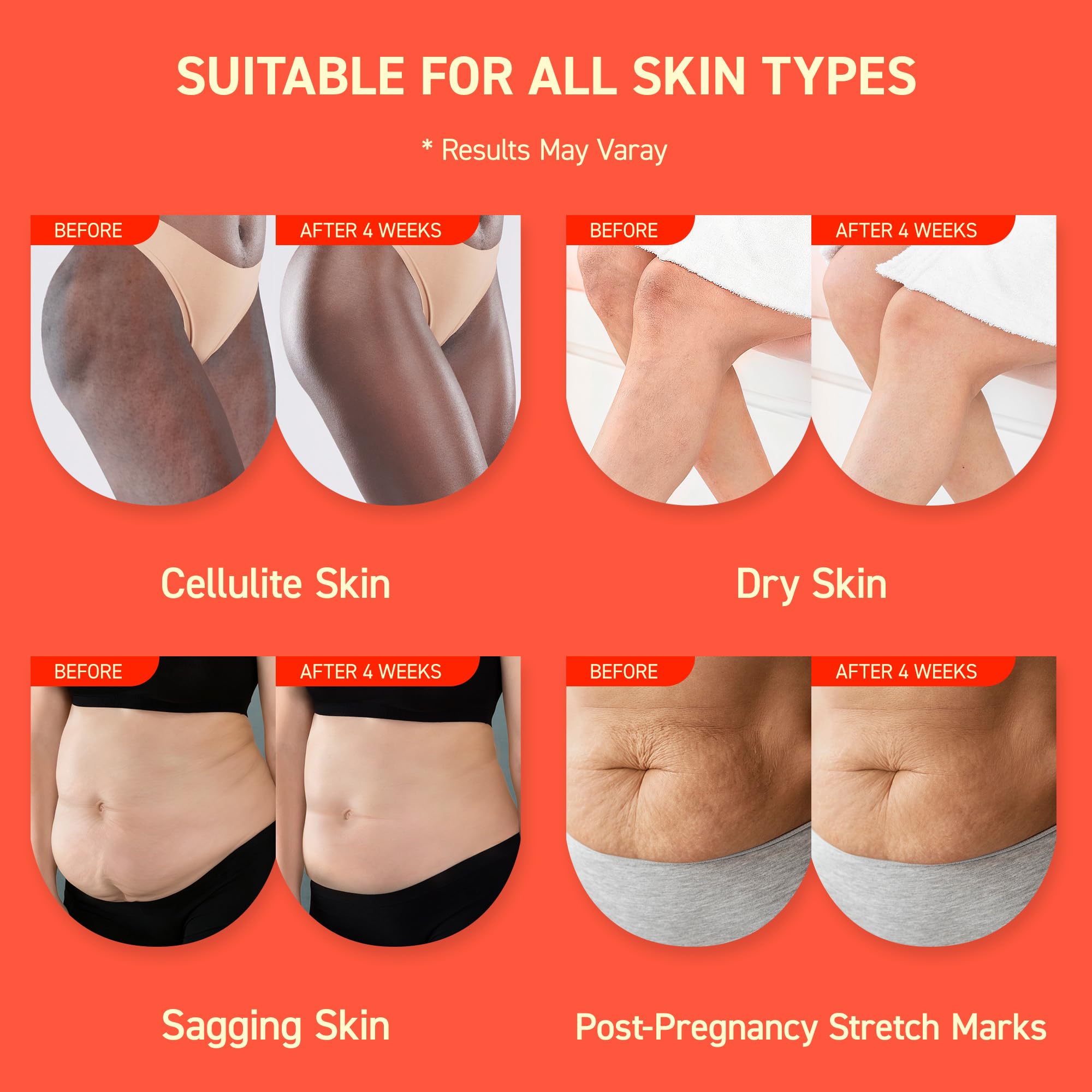 Enaskin Naturals piel madura elasticidad mejorada en muslos y abdomen.