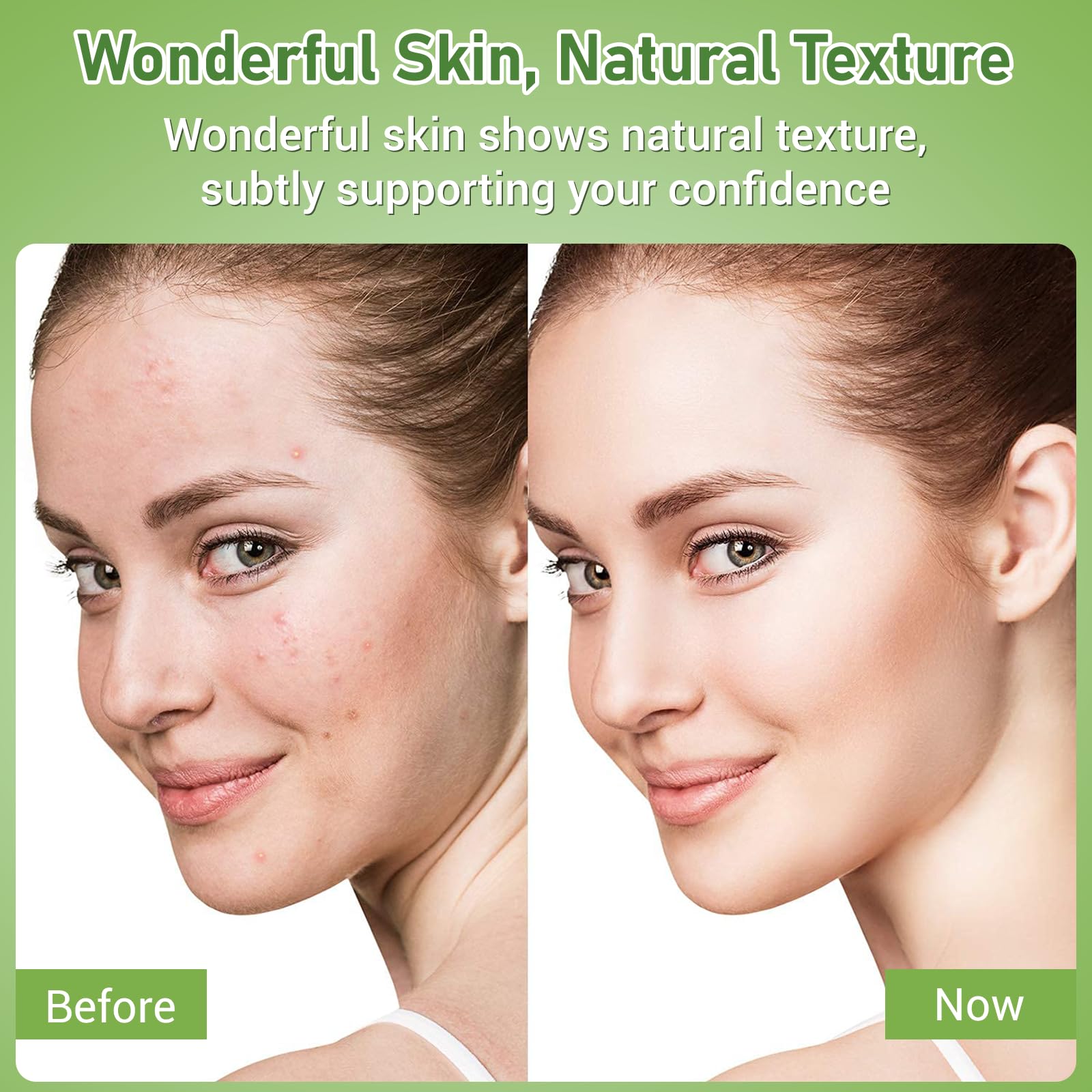 Empaque minimalista de Eofot Crema Azelaico 14