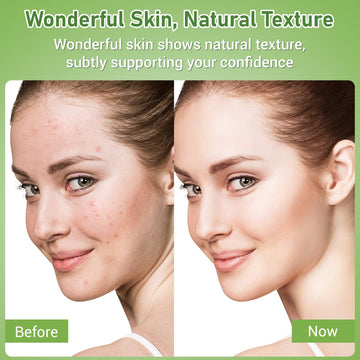Empaque minimalista de Eofot Crema Azelaico 14