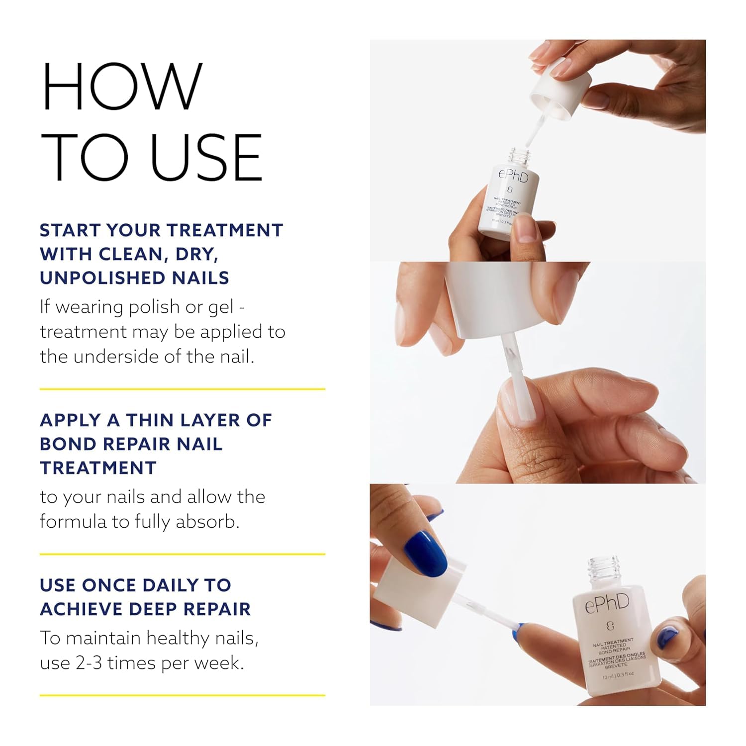 Epres ePhD Brevetee – solution unique pour réparer les ongles endommagés.