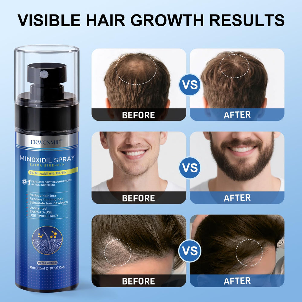 ERWCNMIE Minoxidil Spray aplicación directa al cuero cabelludo para resultados uniformes