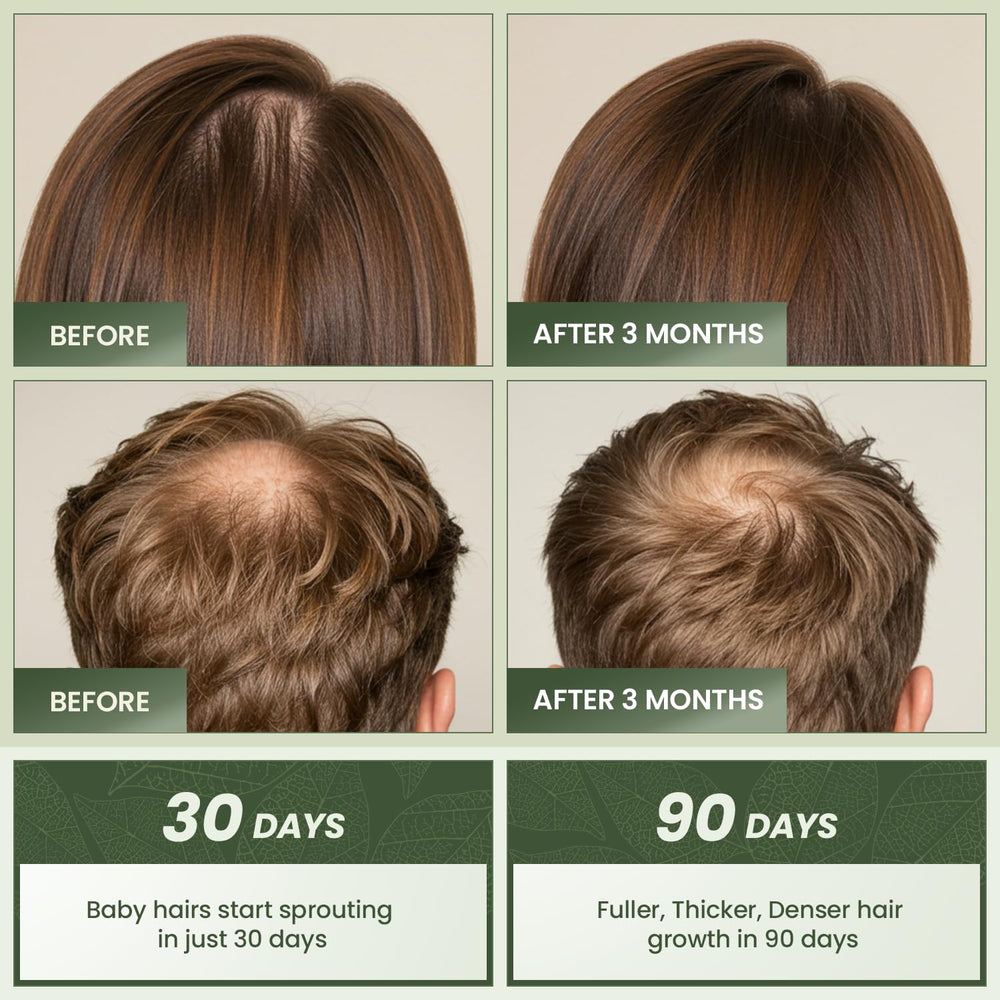 EssyNaturals Advanced: ingredientes naturales (rosmarino, cafeína y biotina) para nutrir el cabello.