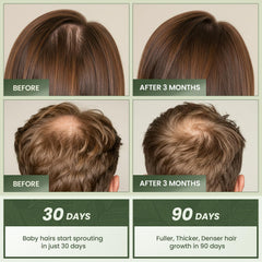 EssyNaturals Advanced: ingredientes naturales (rosmarino, cafeína y biotina) para nutrir el cabello.