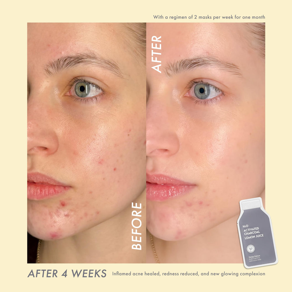 Envase compacto de ESW Beauty Desintoxicación Profunda ideal para uso en casa