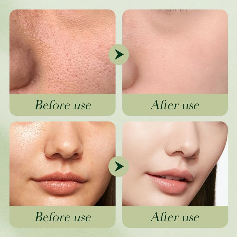 Etuanxi tónico facial de aguacate prepara la piel para absorber productos