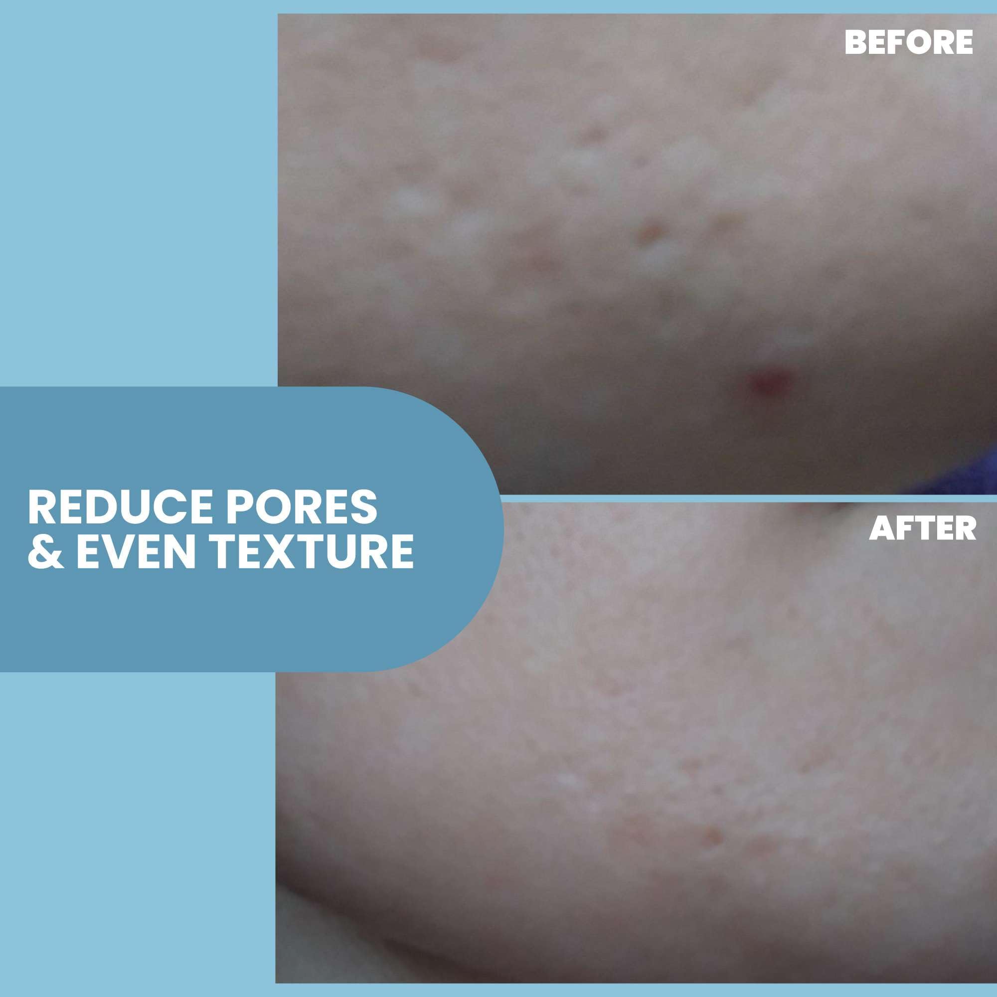 Niacinamida de Eva Naturals armoniza tono y textura