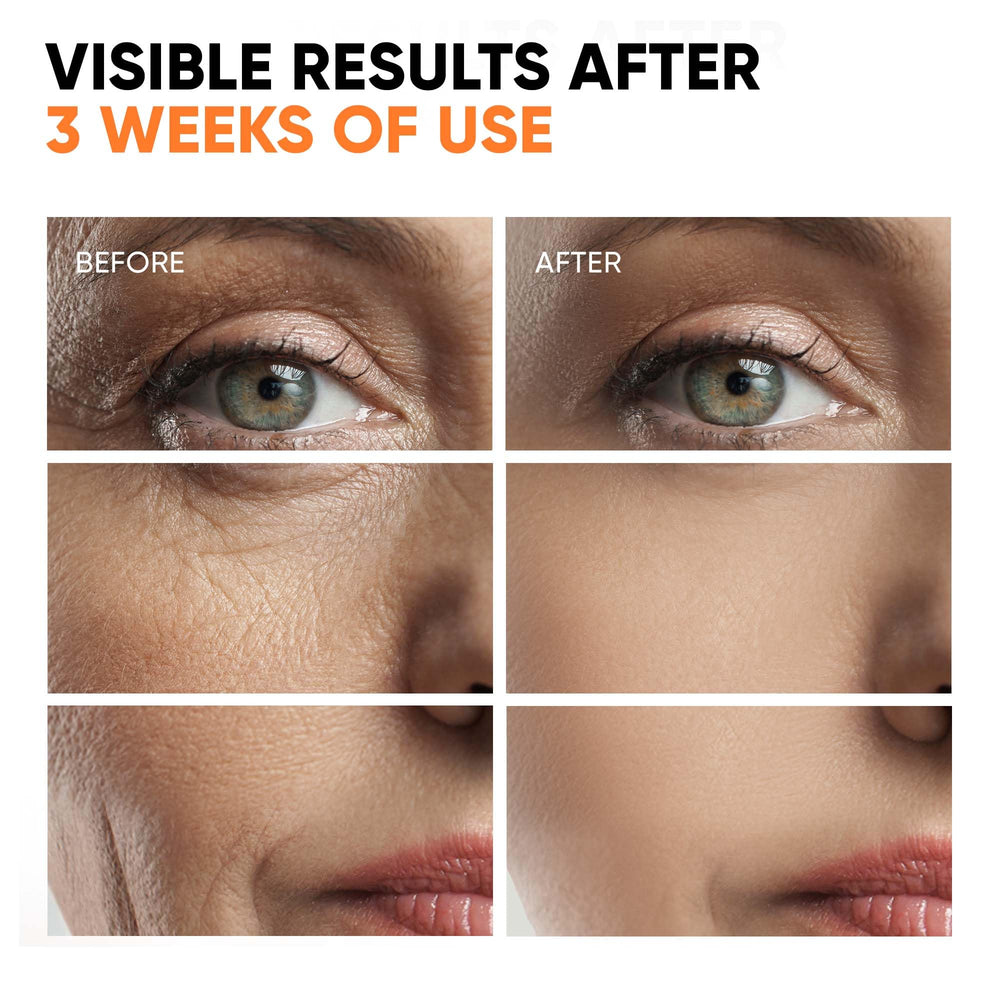 EVERYOUTH Sérum Retinol y retinal, exfolia suavemente para un tono más uniforme.