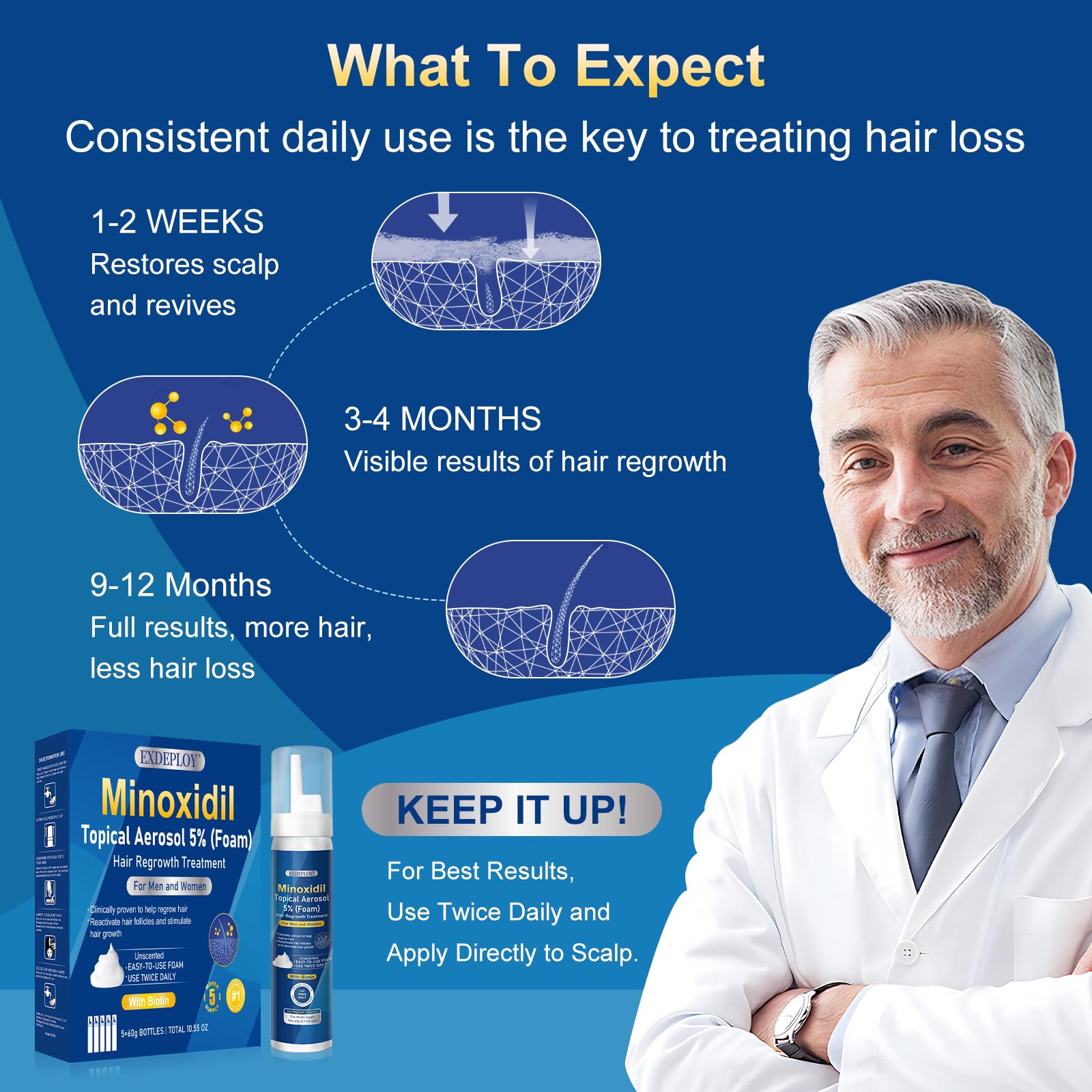 Exdeploy Minoxidil Mousse : appliquer sur le cuir chevelu pour densifier