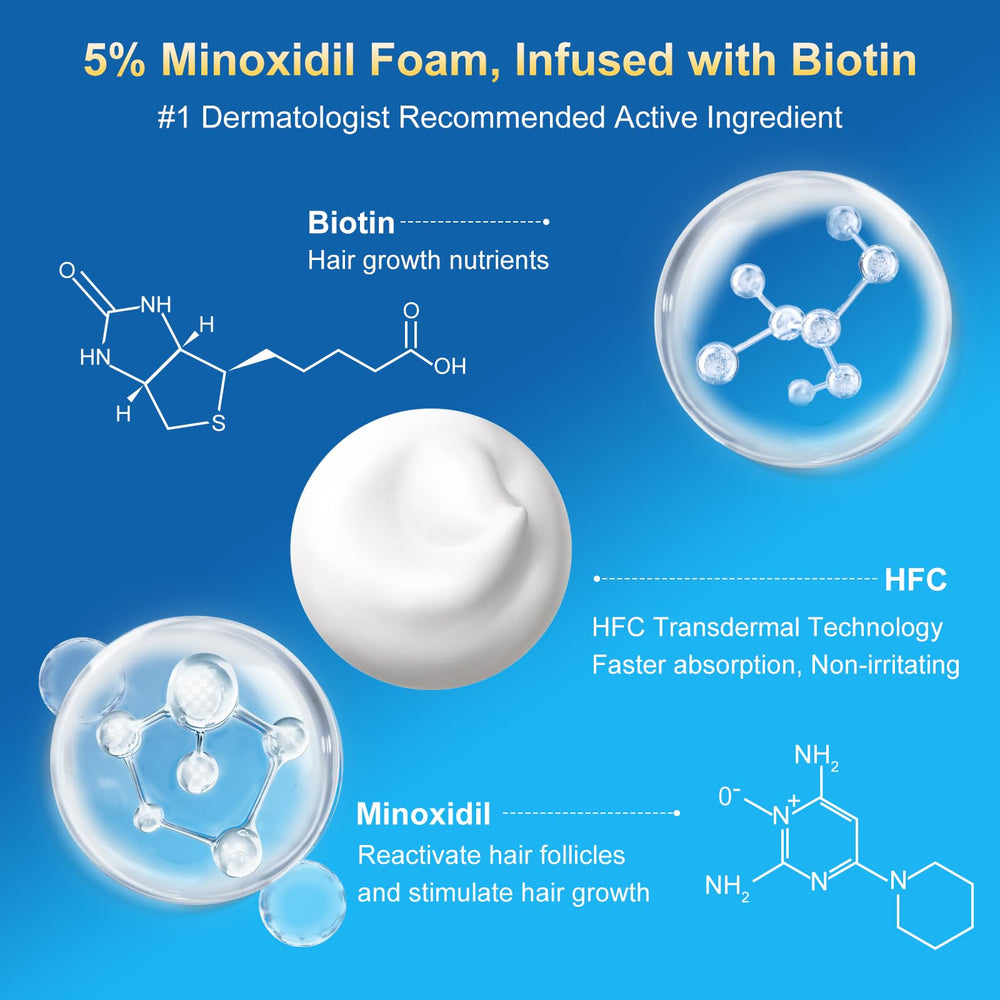 Packaging Exdeploy Minoxidil Mousse, lot de cinq mois pour un traitement durable