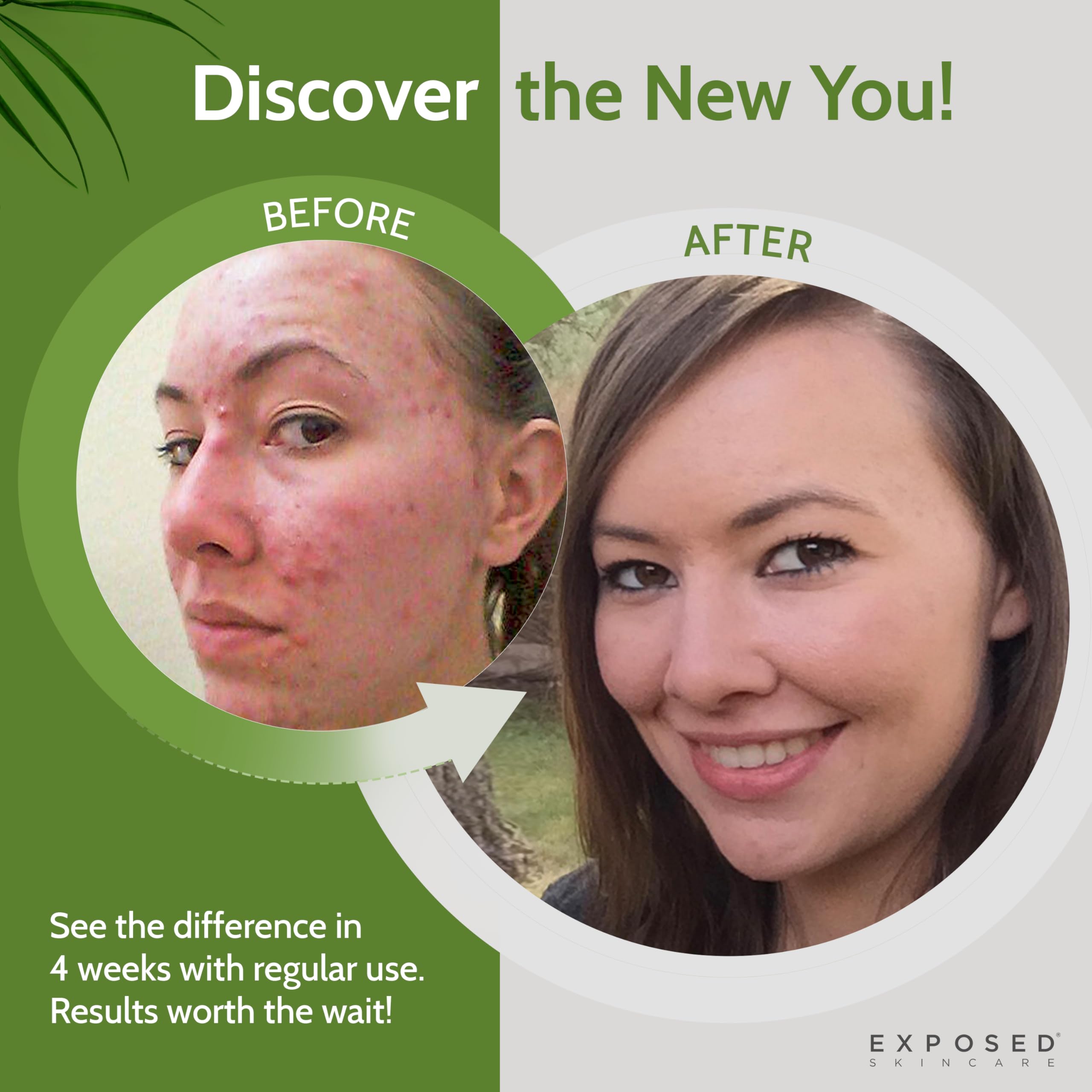 Exposed Skin Care: aplicación en la mano para iniciar la rutina diaria.