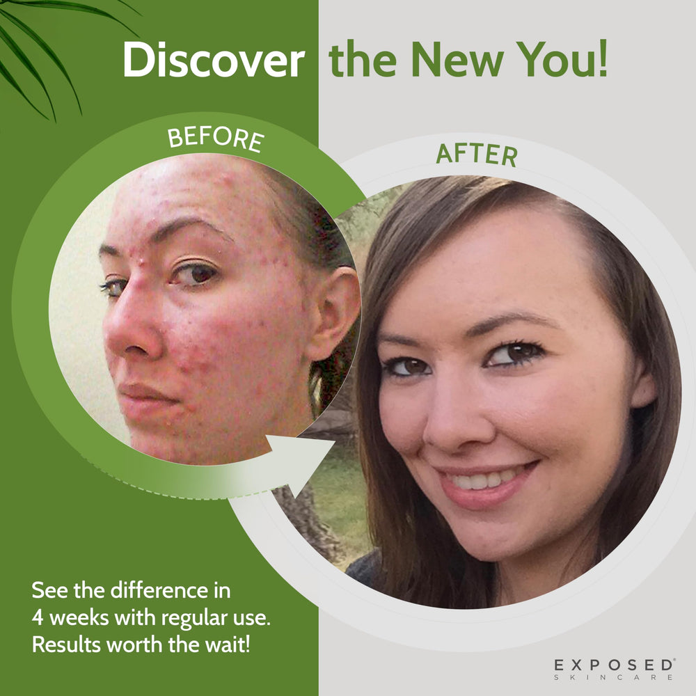 Exposed Skin Care: aplicación en la mano para iniciar la rutina diaria.