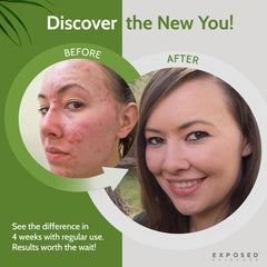 Exposed Skin Care: aplicación en la mano para iniciar la rutina diaria.