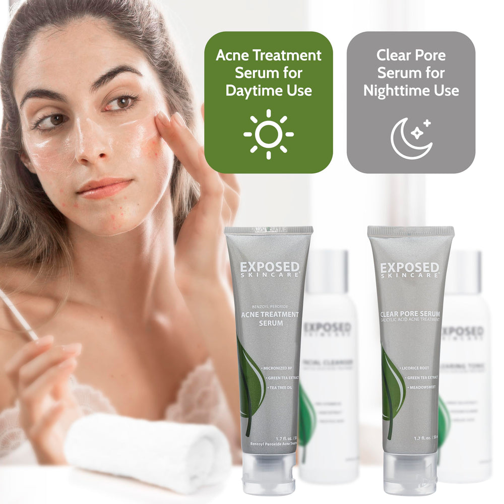 Exposed Skin Care kit: dos meses de uso diario recomendado.