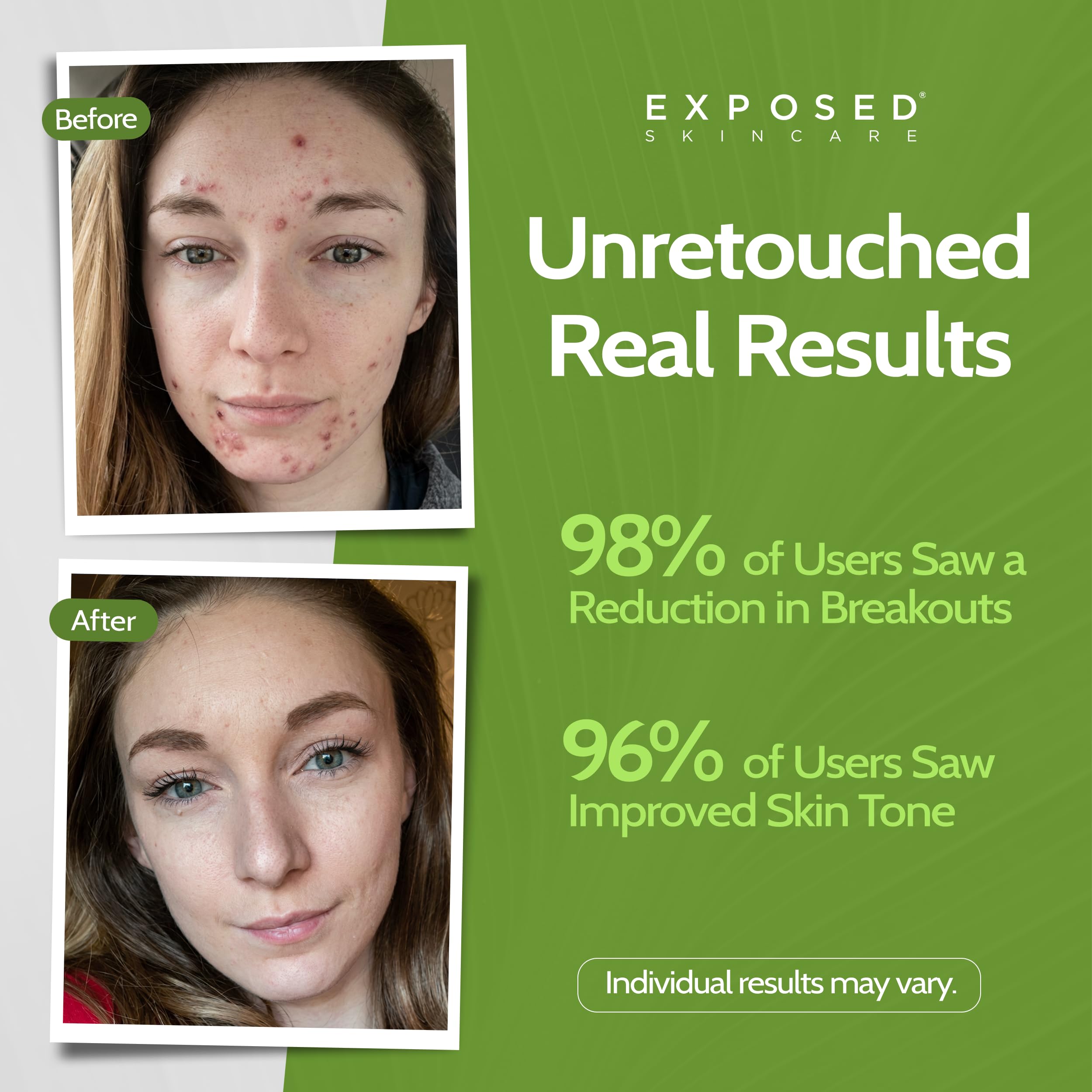 Exposed Skin Care: textura suave de gel listo para limpieza facial.