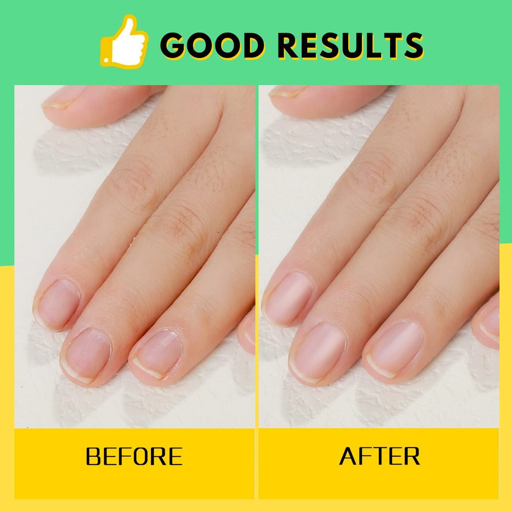 Aceite cutícula leche y miel FANDAMEI para hidratar uñas y cutículas