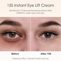 Sodium DNA Fankr – soutien au renouvellement autour des yeux.