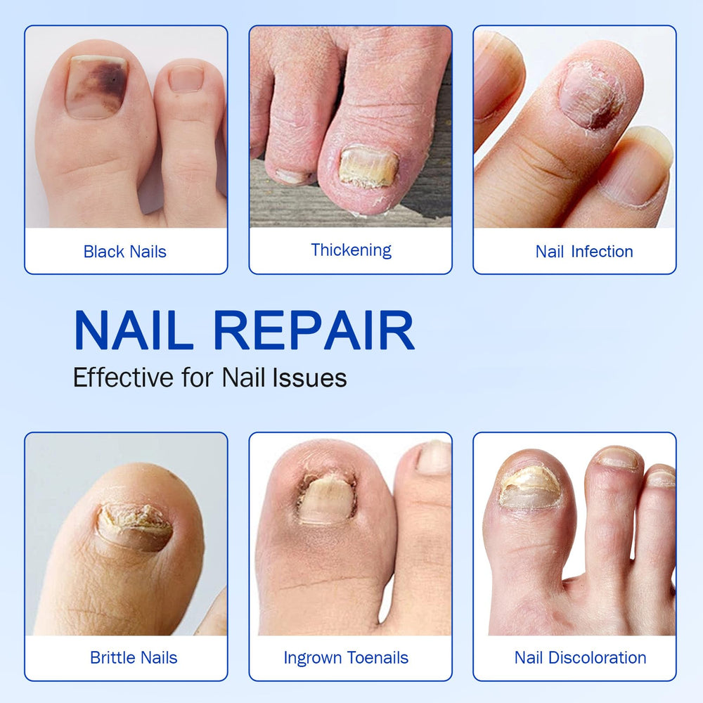 FANSHI patches highlighting reduced discoloration and smoother nail surface.