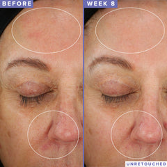 Farmacy Niacinamida Nocturna, barrera hidratada para piel más resistente.